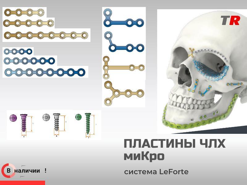Пластины прямые и фигурные миКро + винты система LeForte В Наличии